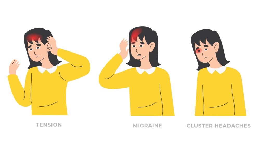 Illustration of three types of headaches: tension (affecting both sides), migraine (affecting one side), and cluster headaches (localized pain around the eye), each shown on a person. A headache chiropractor might offer relief by addressing these specific pain areas.